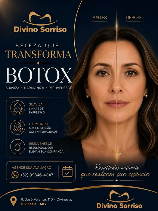 Botox antes e depois